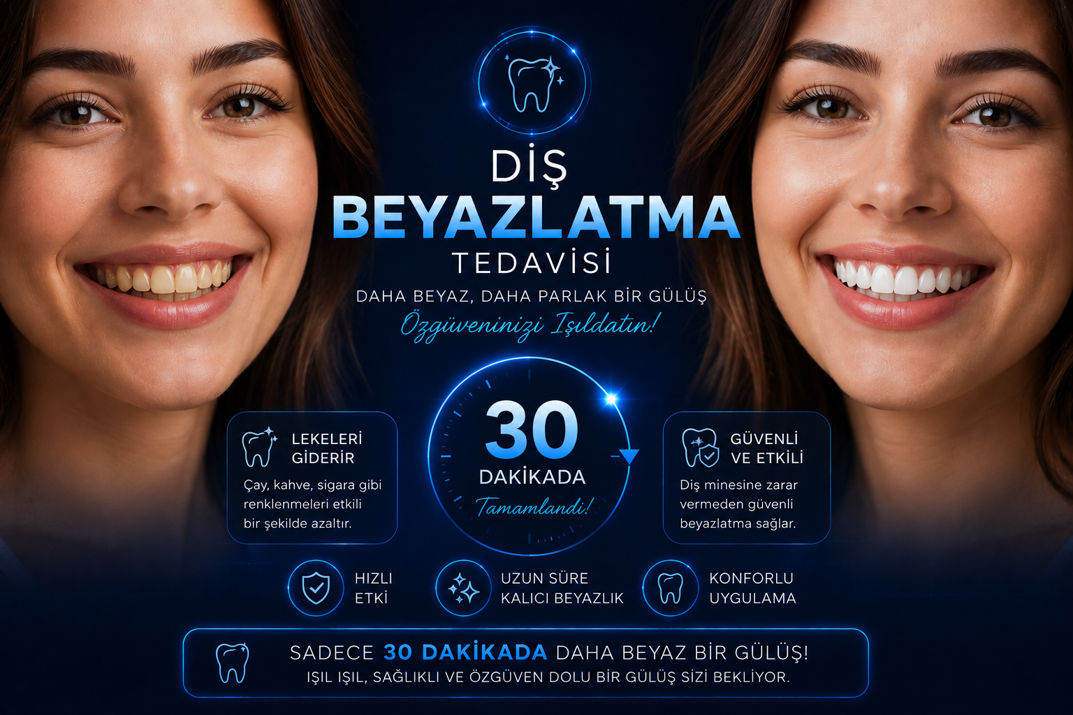 Diş Beyazlatma